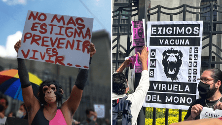 Exigen atención contra viruela del mono; ONUSIDA exige evitar discursos anti lgbt