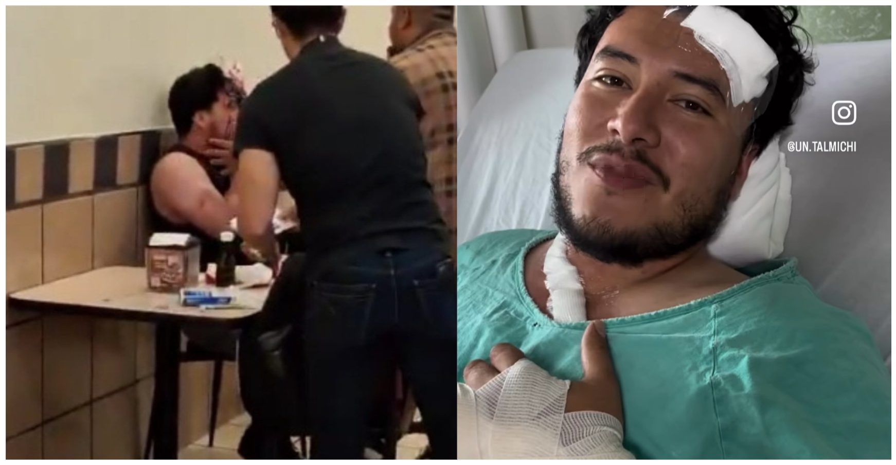 Agresión homofóbica en Puebla